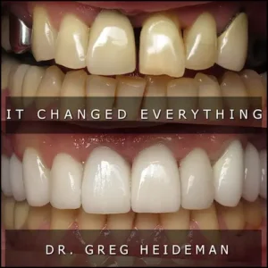 Before and After Crowns | Luth And Heideman Center