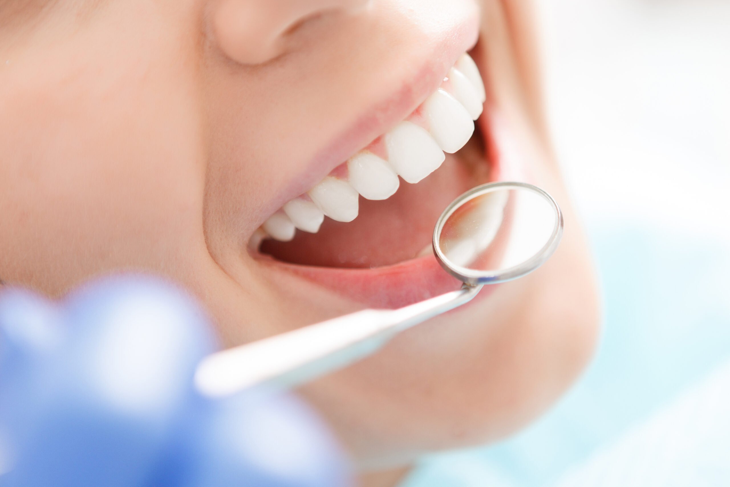4 Ways A Full Mouth Reconstruction Can Improve Oral Health