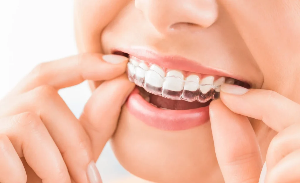 invisalign treatment dentist las vegas nevada nv luth and heideman mfrh original scaled 1