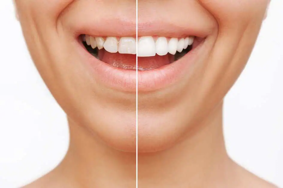 Gum Shaping Treatments in Las Vegas, NV by Luth And Heideman Center For Dental Care