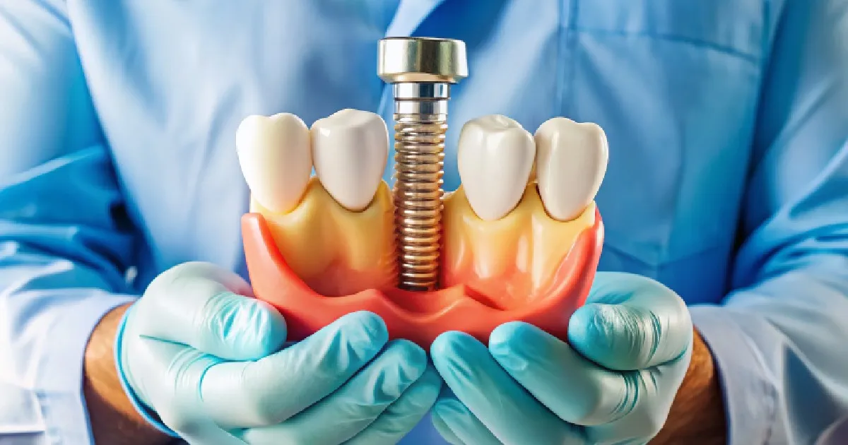 Dental Implants in Las Vegas, NV